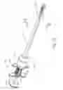 Fig. 23 - Marker delivery device for use with MRI breast biopsy system