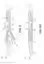 Fig. 06 - Biopsy devices and related methods of use