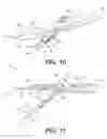 Fig. 07 - Biopsy devices and related methods of use