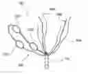Fig. 01 - Suture anchor assembly and method of passing same suture multiple times