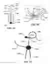 Fig. 07 - Surgical filament snare assemblies