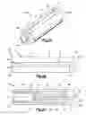 Fig. 03 - Soft tissue fixation system