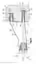 Fig. 09 - Soft tissue fixation system