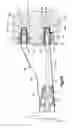 Fig. 10 - Soft tissue fixation system