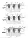 Fig. 11 - Soft tissue fixation system
