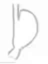 Fig. 03 - Methods and devices for manipulating and fastening tissue
