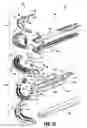 Fig. 08 - Tissue stop for surgical instrument