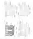 Fig. 199 - FASTENER CARTRIDGE COMPRISING A TISSUE THICKNESS COMPENSATOR AND A GAP SETTING ELEMENT