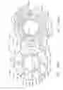 Fig. 205 - FASTENER CARTRIDGE COMPRISING A TISSUE THICKNESS COMPENSATOR AND A GAP SETTING ELEMENT