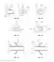 Fig. 03 - Devices and Methods for Delivery of Materials into the Nose