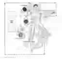 Fig. 01 - Method and apparatus for treating a joint, including the treatment of cam-type femoroacetabular impingement in a hip joint and pincer-type femoroacetabular impingement in a hip joint