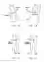Fig. 02 - Method and apparatus for treating a joint, including the treatment of cam-type femoroacetabular impingement in a hip joint and pincer-type femoroacetabular impingement in a hip joint