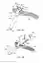 Fig. 08 - Systems and methods for intramedullary nail implantation