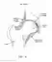 Fig. 07 - METHOD AND APPARATUS FOR RECONSTRUCTING A HIP JOINT, INCLUDING THE PROVISION AND USE OF A NOVEL ARTHROSCOPIC DEBRIDEMENT TEMPLATE FOR ASSISTING IN THE TREATMENT OF CAM-TYPE FEMOROACETABULAR IMPINGEMENT