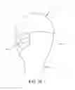 Fig. 17 - METHOD AND APPARATUS FOR RECONSTRUCTING A HIP JOINT, INCLUDING THE PROVISION AND USE OF A NOVEL ARTHROSCOPIC DEBRIDEMENT TEMPLATE FOR ASSISTING IN THE TREATMENT OF CAM-TYPE FEMOROACETABULAR IMPINGEMENT