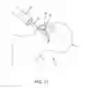 Fig. 18 - METHOD AND APPARATUS FOR RECONSTRUCTING A HIP JOINT, INCLUDING THE PROVISION AND USE OF A NOVEL ARTHROSCOPIC DEBRIDEMENT TEMPLATE FOR ASSISTING IN THE TREATMENT OF CAM-TYPE FEMOROACETABULAR IMPINGEMENT