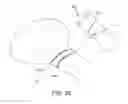 Fig. 42 - METHOD AND APPARATUS FOR RECONSTRUCTING A HIP JOINT, INCLUDING THE PROVISION AND USE OF A NOVEL ARTHROSCOPIC DEBRIDEMENT TEMPLATE FOR ASSISTING IN THE TREATMENT OF CAM-TYPE FEMOROACETABULAR IMPINGEMENT