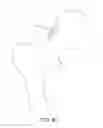Fig. 45 - METHOD AND APPARATUS FOR RECONSTRUCTING A HIP JOINT, INCLUDING THE PROVISION AND USE OF A NOVEL ARTHROSCOPIC DEBRIDEMENT TEMPLATE FOR ASSISTING IN THE TREATMENT OF CAM-TYPE FEMOROACETABULAR IMPINGEMENT