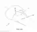 Fig. 47 - METHOD AND APPARATUS FOR RECONSTRUCTING A HIP JOINT, INCLUDING THE PROVISION AND USE OF A NOVEL ARTHROSCOPIC DEBRIDEMENT TEMPLATE FOR ASSISTING IN THE TREATMENT OF CAM-TYPE FEMOROACETABULAR IMPINGEMENT