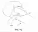 Fig. 48 - METHOD AND APPARATUS FOR RECONSTRUCTING A HIP JOINT, INCLUDING THE PROVISION AND USE OF A NOVEL ARTHROSCOPIC DEBRIDEMENT TEMPLATE FOR ASSISTING IN THE TREATMENT OF CAM-TYPE FEMOROACETABULAR IMPINGEMENT