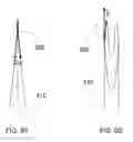 Fig. 07 - Method and apparatus for tissue grafting and copying