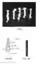 Fig. 09 - Method and apparatus for tissue grafting and copying