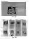 Fig. 15 - Method and apparatus for tissue grafting and copying