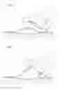 Fig. 05 - Medical tool for endoscope