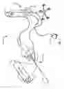 Fig. 02 - Catheter With Retractable Sheath And Methods Thereof