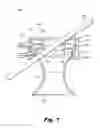 Fig. 02 - LOW-PROFILE SURGICAL ACCESS DEVICES WITH ANCHORING