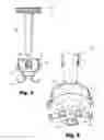 Fig. 09 - LOW-PROFILE SURGICAL ACCESS DEVICES WITH ANCHORING
