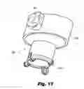 Fig. 14 - LOW-PROFILE SURGICAL ACCESS DEVICES WITH ANCHORING