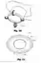 Fig. 16 - LOW-PROFILE SURGICAL ACCESS DEVICES WITH ANCHORING