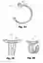 Fig. 18 - LOW-PROFILE SURGICAL ACCESS DEVICES WITH ANCHORING