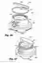 Fig. 24 - LOW-PROFILE SURGICAL ACCESS DEVICES WITH ANCHORING