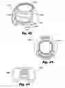 Fig. 26 - LOW-PROFILE SURGICAL ACCESS DEVICES WITH ANCHORING