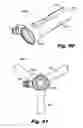 Fig. 35 - LOW-PROFILE SURGICAL ACCESS DEVICES WITH ANCHORING