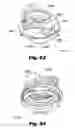 Fig. 37 - LOW-PROFILE SURGICAL ACCESS DEVICES WITH ANCHORING