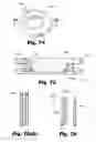 Fig. 42 - LOW-PROFILE SURGICAL ACCESS DEVICES WITH ANCHORING