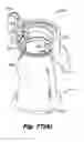 Fig. 43 - LOW-PROFILE SURGICAL ACCESS DEVICES WITH ANCHORING
