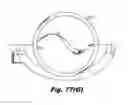 Fig. 48 - LOW-PROFILE SURGICAL ACCESS DEVICES WITH ANCHORING