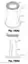 Fig. 49 - LOW-PROFILE SURGICAL ACCESS DEVICES WITH ANCHORING