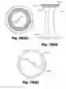 Fig. 50 - LOW-PROFILE SURGICAL ACCESS DEVICES WITH ANCHORING