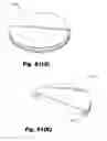 Fig. 57 - LOW-PROFILE SURGICAL ACCESS DEVICES WITH ANCHORING
