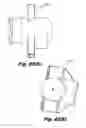 Fig. 61 - LOW-PROFILE SURGICAL ACCESS DEVICES WITH ANCHORING
