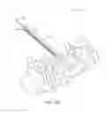 Fig. 13 - Method and device for endoscopic graft delivery using a slotted cannula