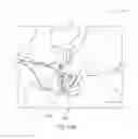 Fig. 29 - Method and device for endoscopic graft delivery using a slotted cannula