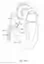 Fig. 22 - Delivery devices and wall apposition sensing