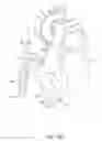 Fig. 23 - Delivery devices and wall apposition sensing