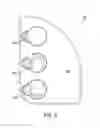 Fig. 09 - System and method for cervical midline fixation